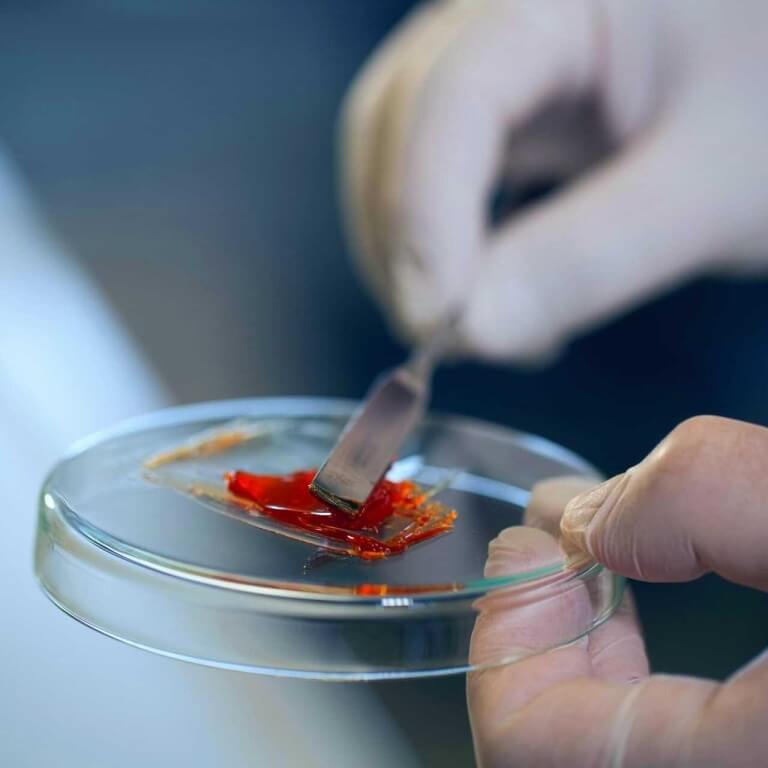 Omc2 Mikroeinglaettung 1 Res 768s